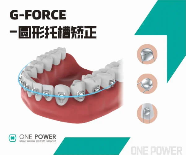 G-Foce(Q型托槽)