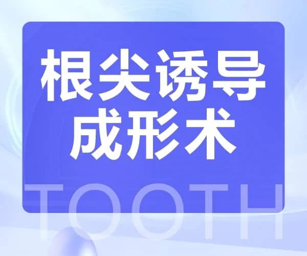 根尖诱导成形术