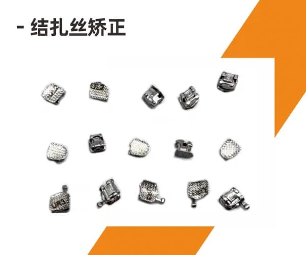 国产结扎丝托槽矫正